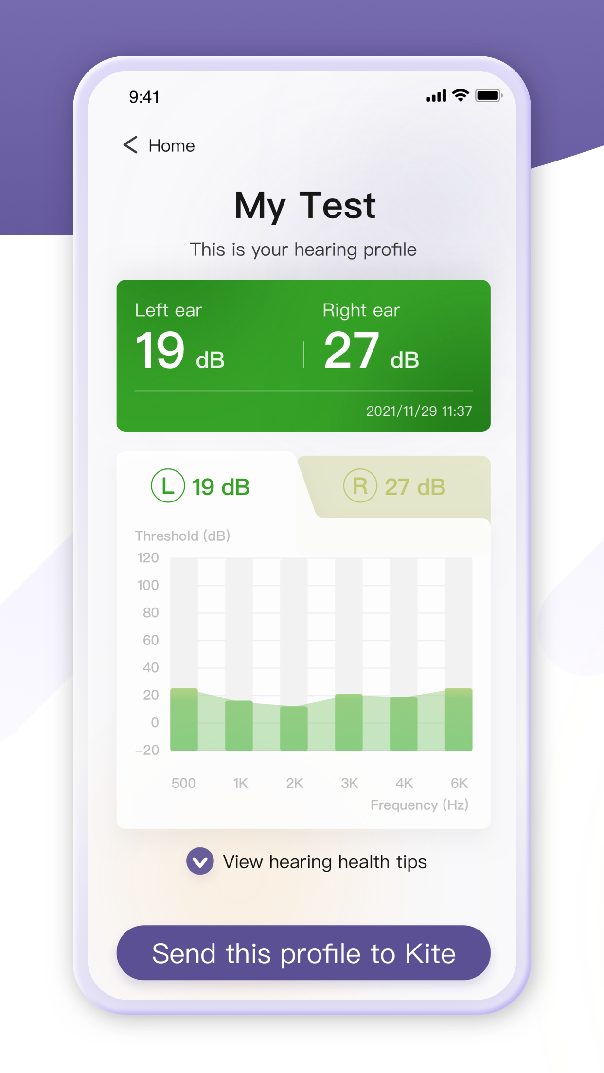 Screenshot of the hearing test result page in the Yinbei app